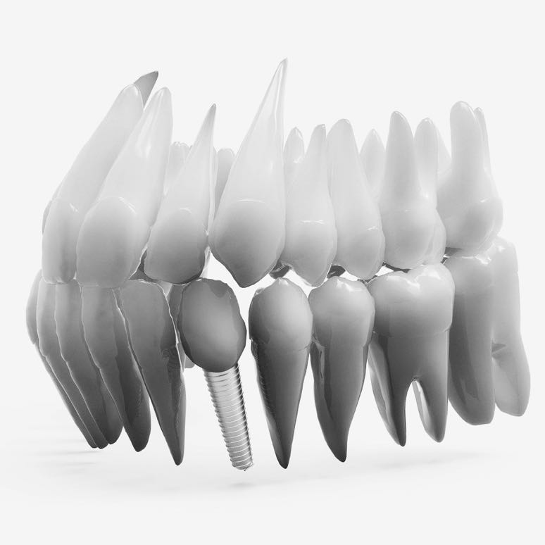 teeth-2833417_1920